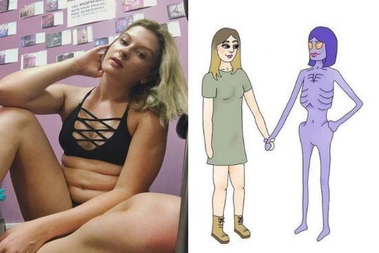 Anoreksiya Yüzünden Yaşadığı Zor Süreci Dürüst Çizimlerle Ortaya Koyan Kadın
