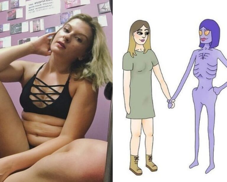 Anoreksiya Yüzünden Yaşadığı Zor Süreci Dürüst Çizimlerle Ortaya Koyan Kadın