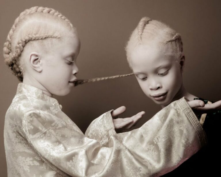 Benzersiz Güzellikleriyle Moda Endüstrisinde Fırtınalar Estiren Brezilyalı Albino İkizler
