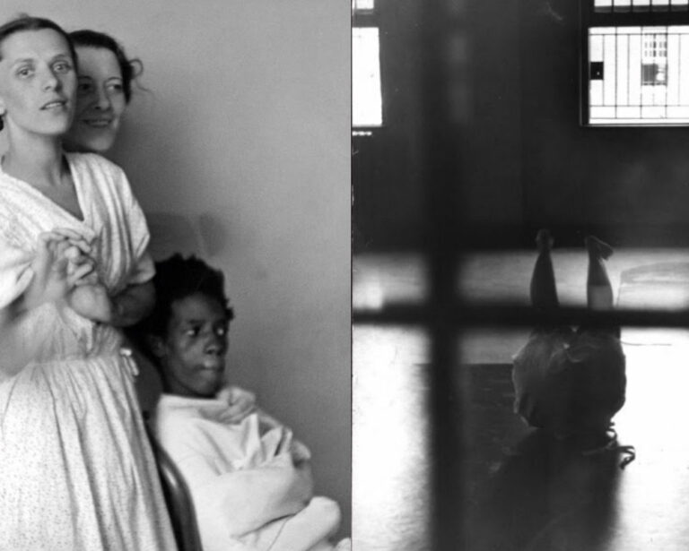 1930’larda Büyük Bir Akıl Hastanesinde Çekilmiş 22 Ürkütücü Fotoğraf