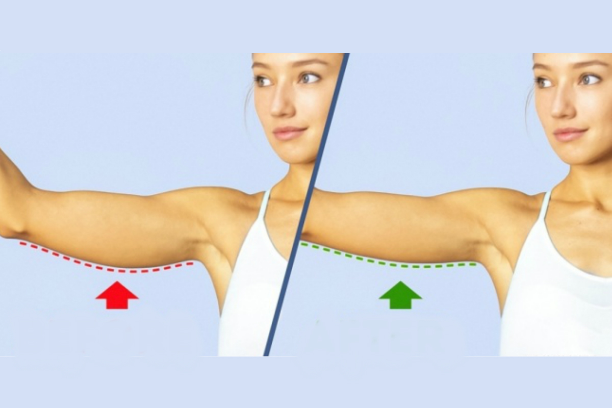 En Iyi Triceps Hareketleri Resimli Anlatim Vucut Gelistirme Hareketleri Zayiflama Egzersizleri Fitness Hareketleri