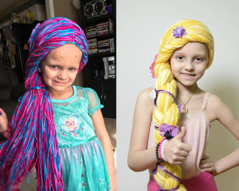 Sihirli İplik Peruklar Üreterek Kanserli Çocukların Yüzünü Güldüren Proje